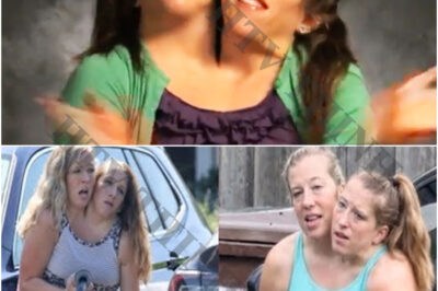 The Conjoined Twins SURPRISE We Have Been Separated!